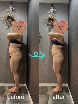 ナナ整骨鍼灸院 ココ(Nana整骨鍼灸院 Coco)/