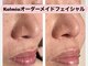 カルミア(kalmia)の写真