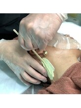 ハニーアイズ(Honey Eyes)/【女性うなじmixスッキリ脱毛】