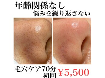 フワットン(Fouatons)