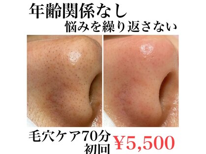 フワットン(Fouatons)の写真