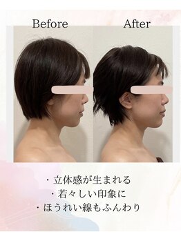 オリナサツキ(OlinaSatsuki)/若々しさの秘訣は頬！