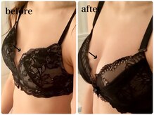 ブレスト 新宿本店(Breast)/《3回目》20代（バストアップ）