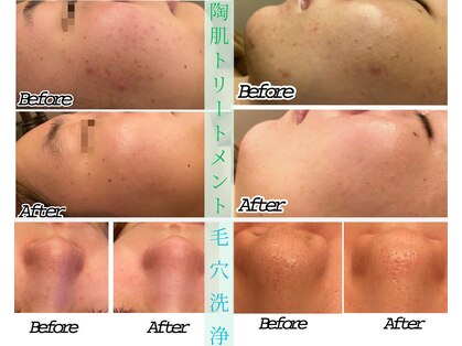 アクアプラス(AQUA+)の写真