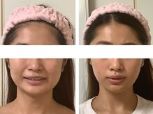 KOGAO LABO  甲府店/☆Before&After☆