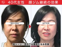 顔ジム 麻布店/40代女性顔ジム継続の効果