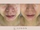 リノン(LINON)の写真