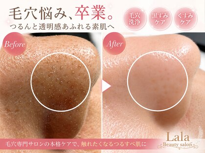 ララ(Lala)の写真