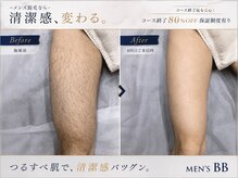 メンズビービー 福井高柳店(MEN'S BB)の雰囲気（カウンセリングのみ大歓迎♪コース終了後は80％OFF保証制度有◎）