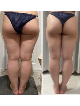 カレン(KAREN)/セルゼロ×脂肪燃焼