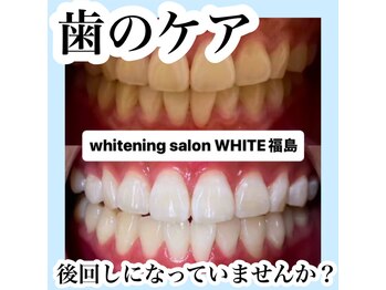 ホワイトニングサロン ホワイト(WHITE)/セルフホワイトニング/大阪/福島