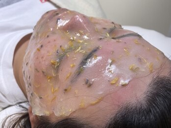 ニコ(nico…)/ワックス後の赤み鎮静パック