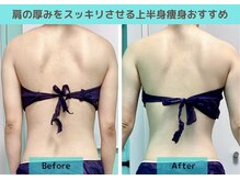 ナナ 銀座(Nana)/サイズダウン！背中にスッキリ