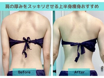 ナナ 銀座(Nana)/サイズダウン!背中にスッキリ