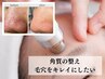 【毛穴ニキビケア】根本改善/皮脂コントロールフェイシャル90分/15400→