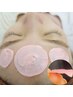【フェイスWAX脱毛+光脱毛】美白効果の高い光脱毛との組み合わせ　6300円