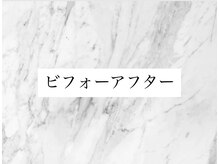 シャイン 蒲田店(SHINE)/ビフォーアフター