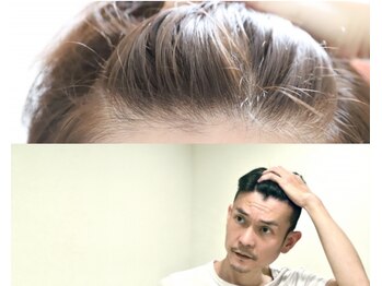 アムール(amour)/★気になる抜け毛・生え際対策★