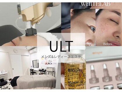 ウルト(ULT)の写真