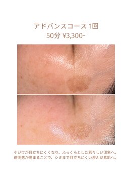 ハピスリー(Hapisley)/掲載許可、頂いております。