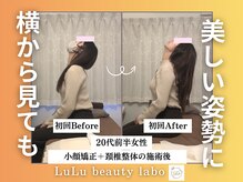 ルルラボ(LuLu beauty labo)/姿勢が変わると、横姿がきれい