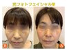 光フォト顔W ¥11,000→¥7,700
