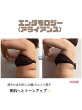 アイリス(AIRIS)/痩身/マッサージ/リンパ/小顔