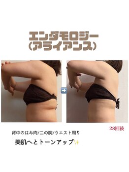 アイリス(AIRIS)/痩身/マッサージ/リンパ/小顔