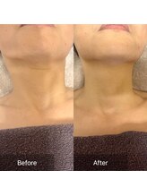 オンリーユータイム(ONLY YOU TIME)/ストレートネック改善