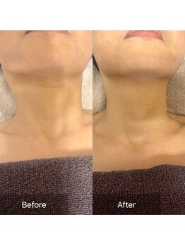 オンリーユータイム(ONLY YOU TIME)/ストレートネック改善