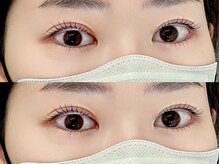 ミーアイラッシュ(ME.eyelash)/LASH LIFT上下