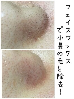 オウカ(OUKA)/ワックスで細かい小鼻の毛も除去