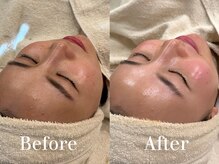 ザ パールズ(The Pearls)/透明感溢れる素肌へ