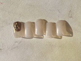 standard 定額