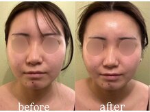 サロンハート(Salon Heart)/