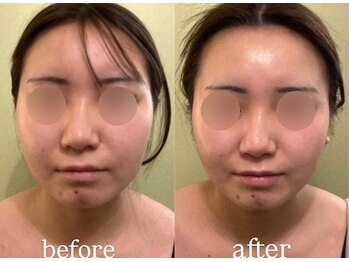 サロンハート(Salon Heart)/