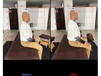 ストレチックス 近江八幡店/ストレッチ ビフォーアフター