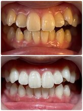 アンドホワイト 八日市店(&white)/メディカルホワイトニング