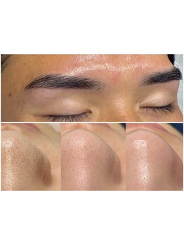 メンズフェイシャル