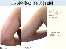 京都フォーエイチ(京都4H)/二の腕が太る根本原因から解決☆