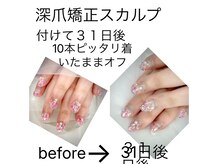 ヒロネイル(Hiro Nail)の雰囲気（どんな深爪でもナチュラルに長さだし可能　持ちも◎）