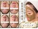 ルーセントの写真