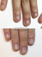 マリーロール 梅田店(Marie Laure)/自爪育成/深爪矯正/ネイルケア