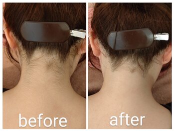 ホクラニ(Hokulani)/脱毛キャンペーン