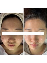 レイ(Rey)/綺麗にします。人生を変えます。