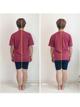 ニコディア(nico-dia)/全身矯正