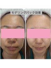 ミイン 宮代(MIIN)/モデリングパック1回効果