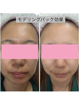 ミイン 宮代(MIIN)/モデリングパック1回効果