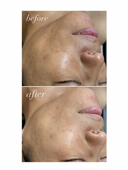 スマイルネイル(SMILE NAIL)/