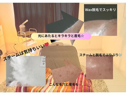 アームスビューティー(aRmsBEAUTY)の写真